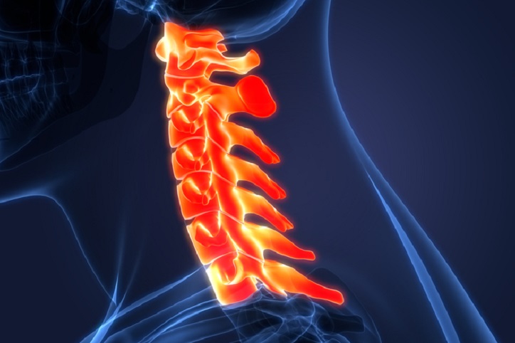 Spinal Cord Injuries